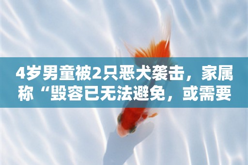 4岁男童被2只恶犬袭击，家属称“毁容已无法避免，或需要全身换血”